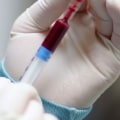 Blood Tests: What You Need to Know